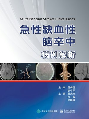 cover image of 急性缺血性脑卒中病例解析